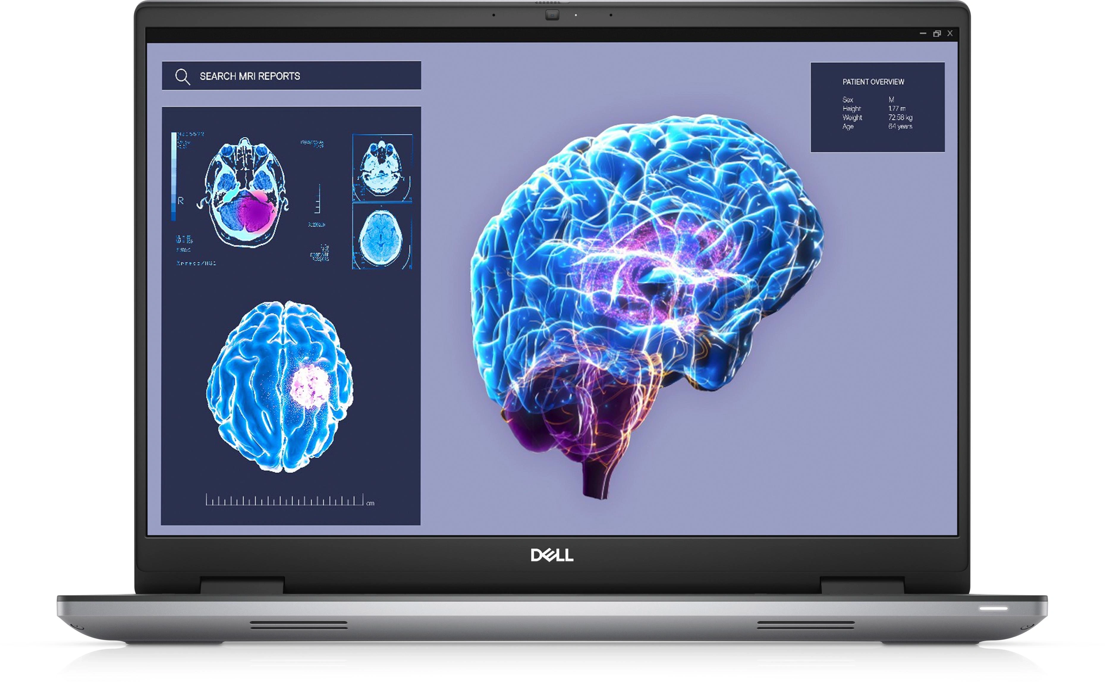 DELL Precision 7680 Intel® Core™ i7 i7-13850HX Estación de trabajo móvil 40,6 cm (16") Full HD+ 32 GB DDR5-SDRAM 1 TB SSD NVIDIA RTX 2000 Ada Wi-Fi 6E (802.11ax) Windows 11 Pro Español Gris